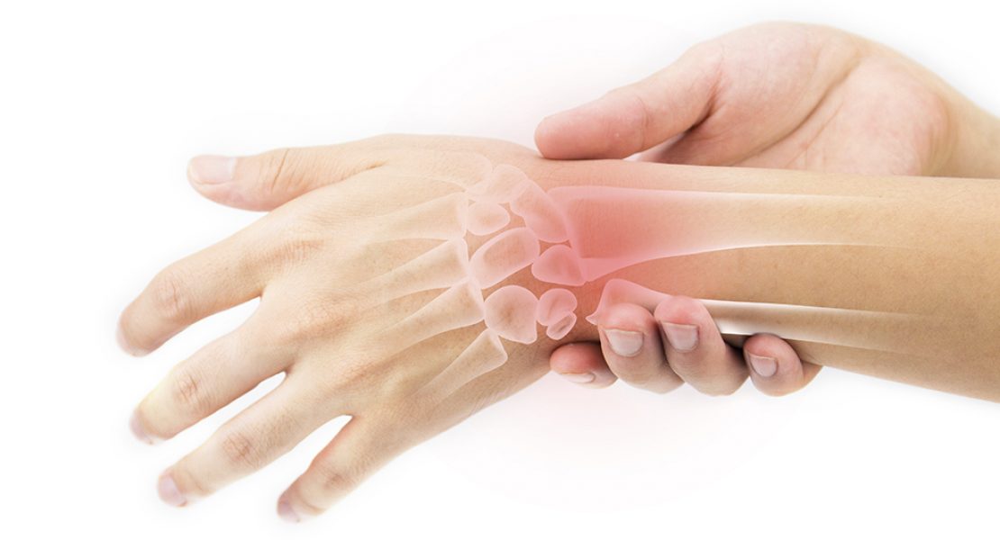 5 Surprising Facts About Rheumatoid Arthritis