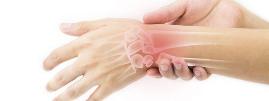 5 Surprising Facts About Rheumatoid Arthritis
